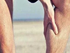 怎样预防静脉曲张 静脉曲张怎么治疗