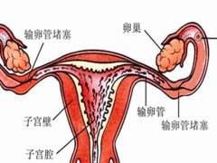 女性卵巢保养方法