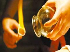 拔罐能去湿气吗 拔罐可以有效祛除湿气吗