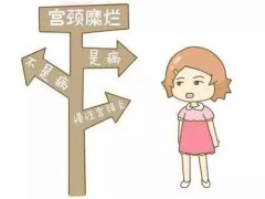 宫颈糜烂的症状 宫颈糜烂是怎样的