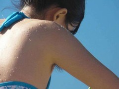 女性狐臭的症状有哪些  狐臭女有哪些症状