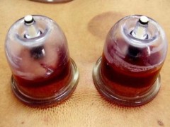 拔火罐后能洗澡吗 拔火罐之后是不建议洗澡的