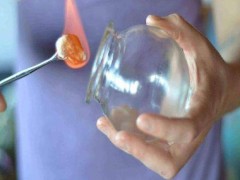 火罐减肥效果好吗  拔火罐能减肥吗