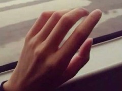 手上长斑是什么原因引起的 手上长斑怎么治