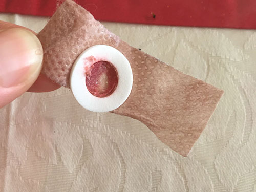 鸡眼膏为什么越贴越疼